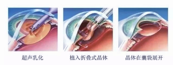 眼科医生吴众预约挂号信息