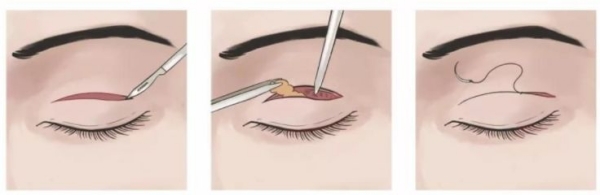 上海愛尚麗格杜圓圓醫生