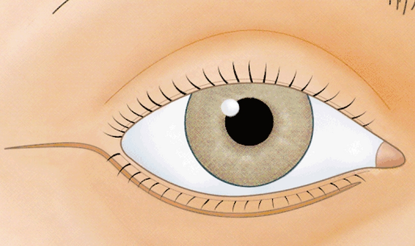 上海愛尚麗格的杜圓圓醫生為什麼難掛