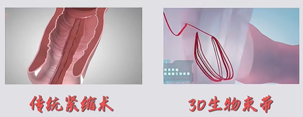 郑州科大医院阴道紧缩的医生技术好吗?业内认可的专门细节