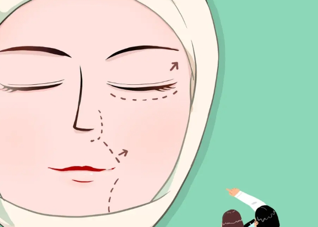 成都友谊整形医院筋膜悬吊手术