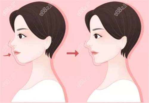 如何分辨自己是不是凸嘴 如何分辨自己是不是凸嘴