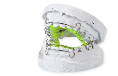 牙齒矯正擴(kuò)弓器