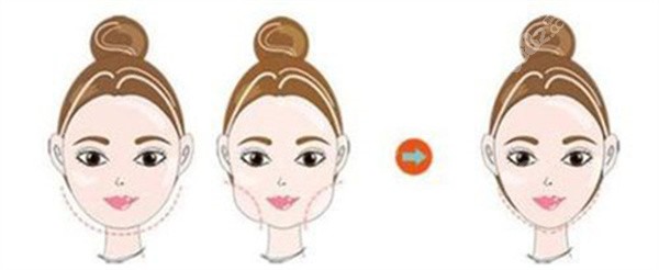 生长因子取出要多少钱？2026全网超全价格明细曝光，避坑必看！