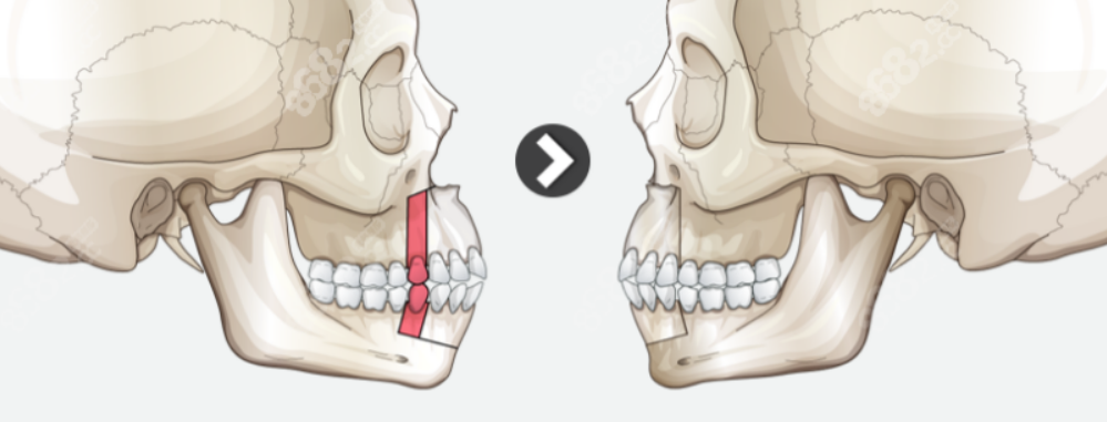 何錦泉在廣州哪家醫(yī)院