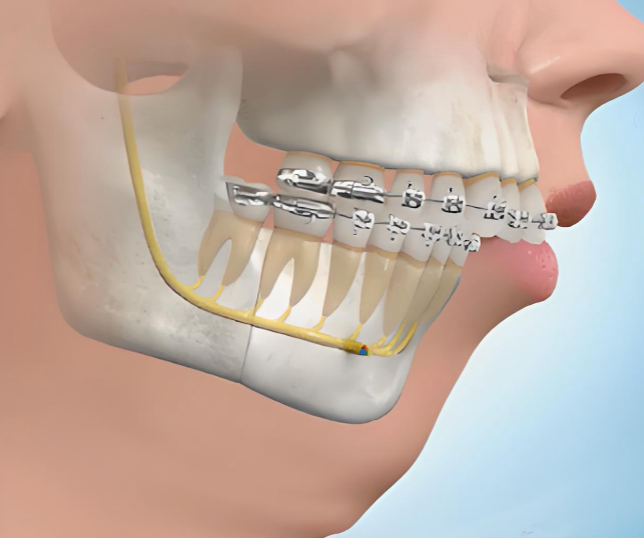 何錦泉在廣州廣大口腔哪個(gè)區(qū)