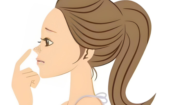 潘峰医生分段式隆鼻效果好不好？支架专利技术让鼻型自然立体还不惧揉捏