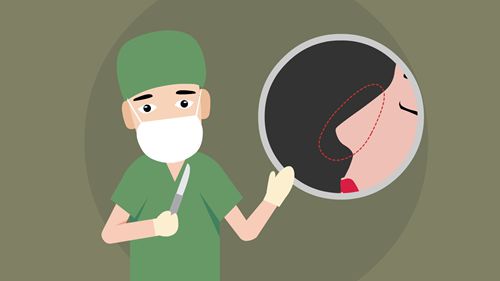 深圳王天国鼻修复价格表明细