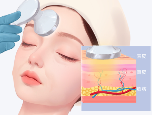 韩国jiwoo皮肤科江南店患者实例分享