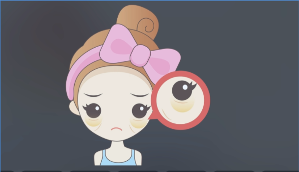 眼袋卧蚕修复