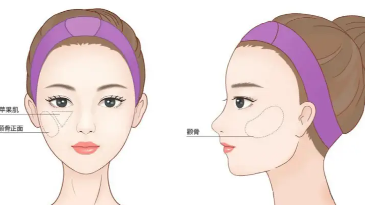 鄧業(yè)平醫(yī)生擅長項(xiàng)目適用人群分析