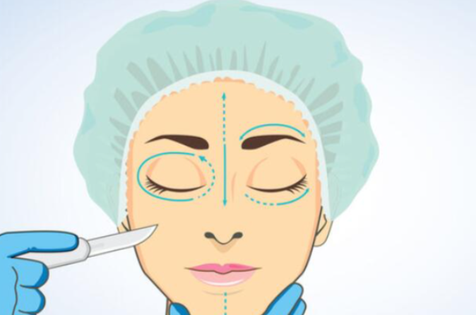 上海筋膜提升dr趙鵬價格影響因素（哪些情況會加價）