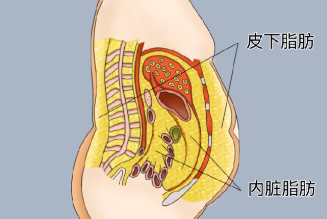 安可忍醫(yī)生腹壁成形