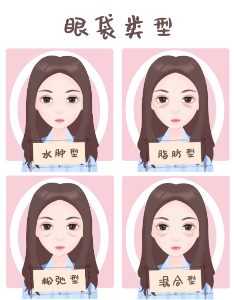 北京紫潔醫(yī)院做眼袋哪個醫(yī)生好