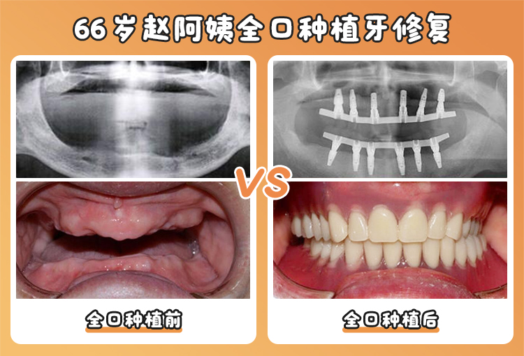 沈陽德立聯(lián)合口腔醫(yī)院營業(yè)時間為8:30 - 17:30，周末可就診解決疑難種牙問題 