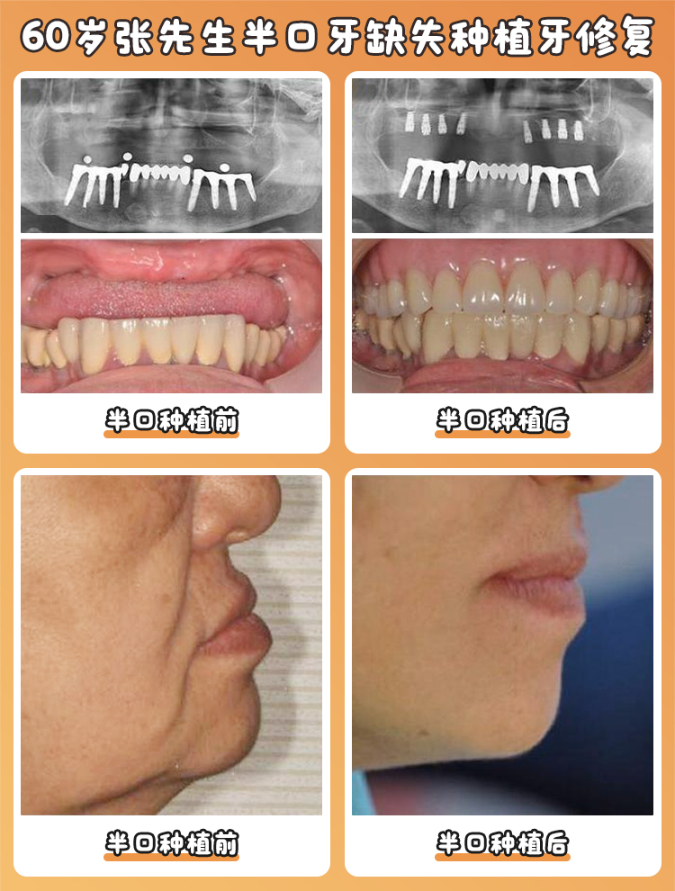 二、沈陽(yáng)德立聯(lián)合口腔醫(yī)院的地址與交通路線
