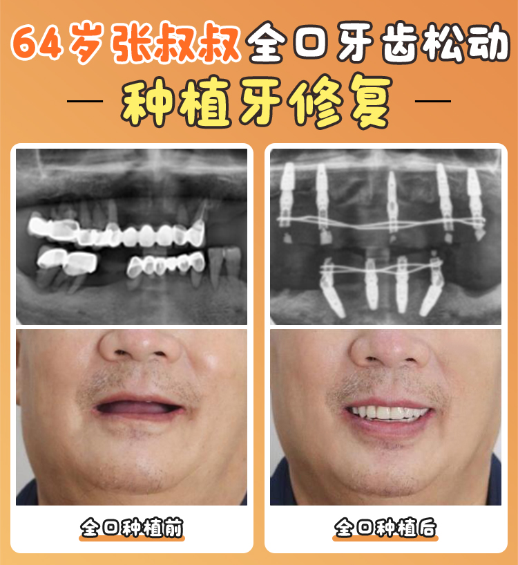 五、沈陽(yáng)德立聯(lián)合口腔醫(yī)院的價(jià)格體系