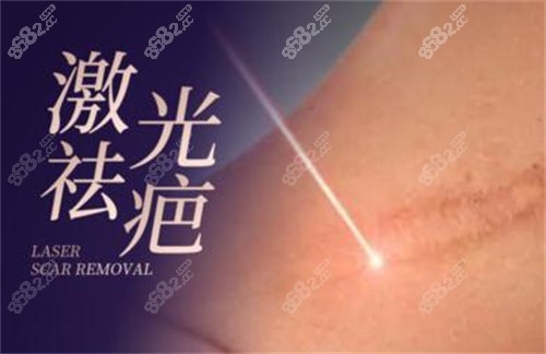 激光祛疤改善照片