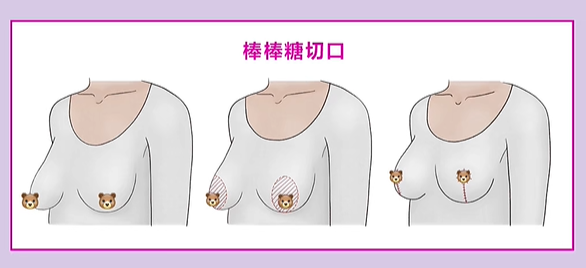 宋新医生擅长联合术式