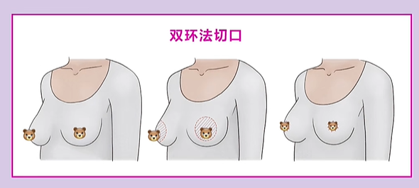 万友望医生耐心解释