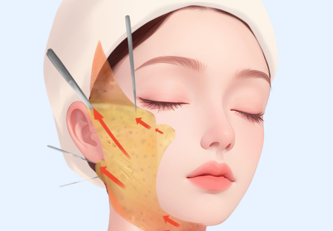 張立彬取異物怎樣:醫(yī)生資質與技術特色