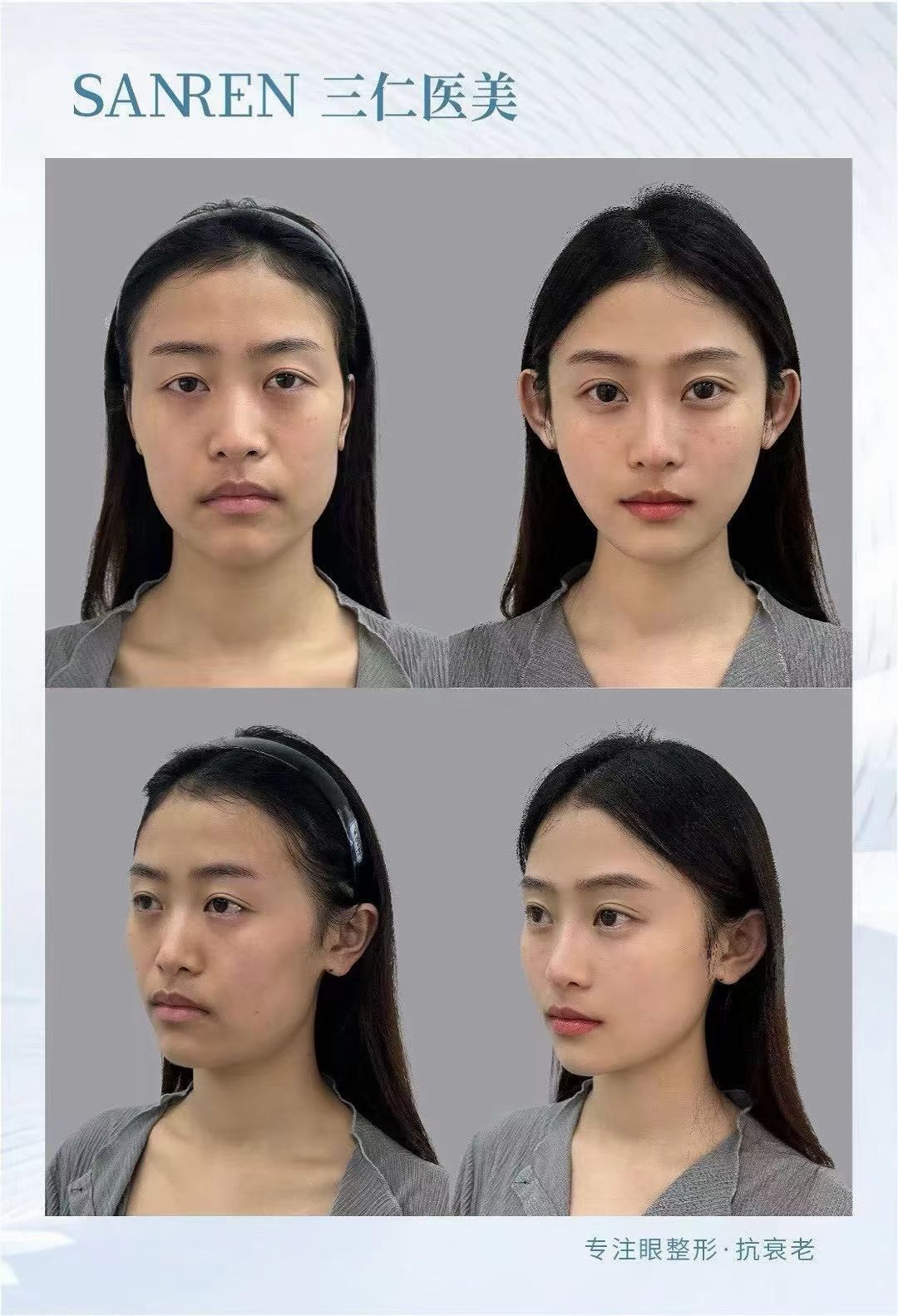 上海藝星醫(yī)院：曼芙佳玻尿酸開(kāi)啟魅力微整