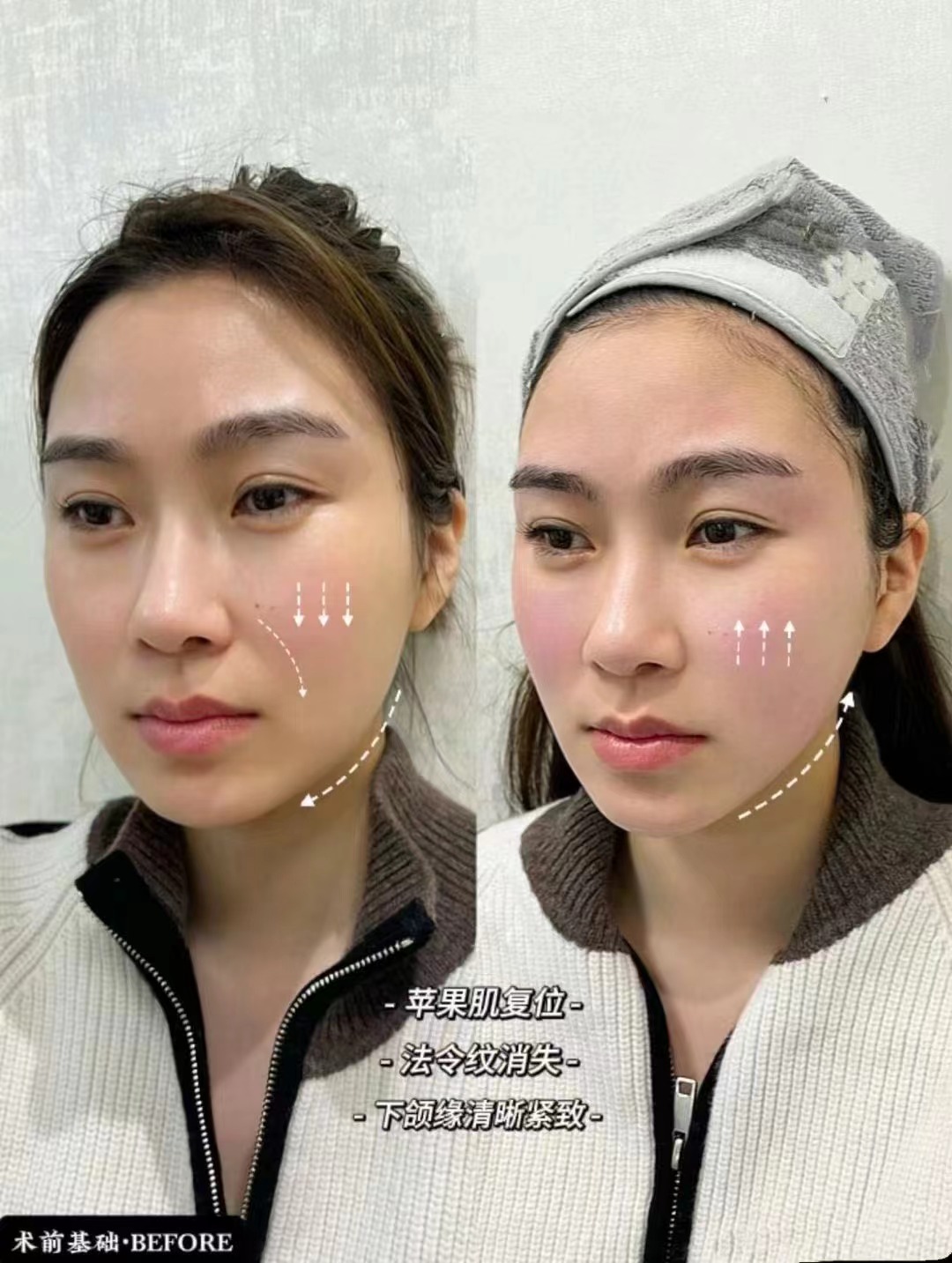 哈爾濱愛爾眼科醫(yī)院：國(guó)內(nèi)熱門的專精之選