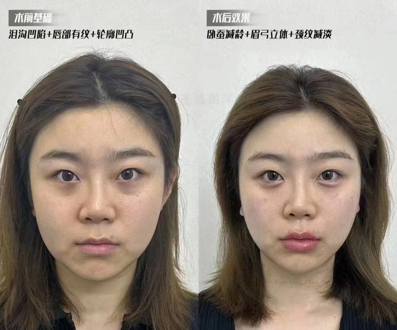 哈爾濱麥迪格眼科醫(yī)院：集團(tuán)化的穩(wěn)定之選