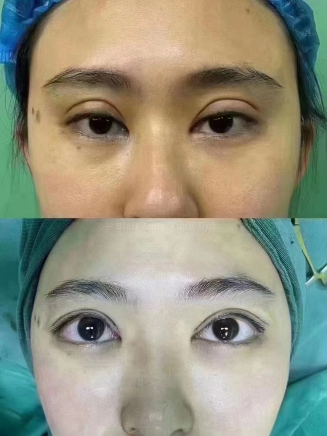 哈爾濱長(zhǎng)庚眼耳鼻喉醫(yī)院：眼病與小兒視光的經(jīng)驗(yàn)之選