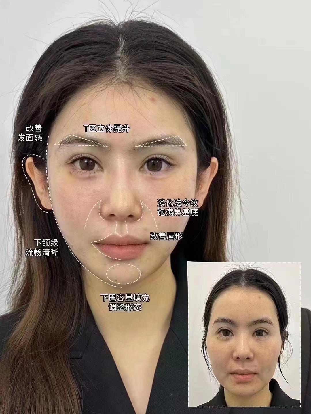 哈爾濱明康眼科：近視防控的使命之選