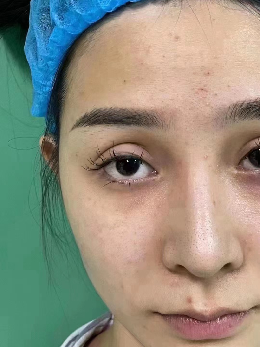 哈爾濱云海眼科醫(yī)院：近視治療的經(jīng)驗(yàn)多之選