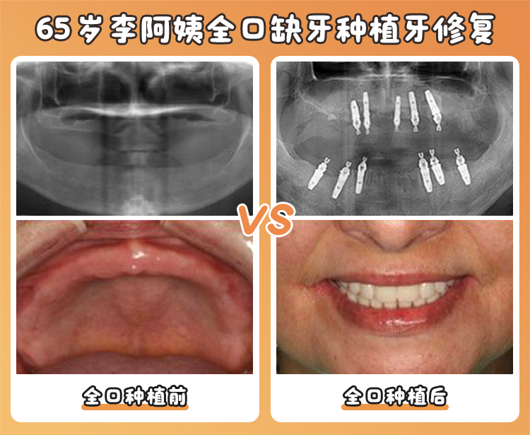 耒陽(yáng)雅貝康口腔的正規(guī)靠譜之處