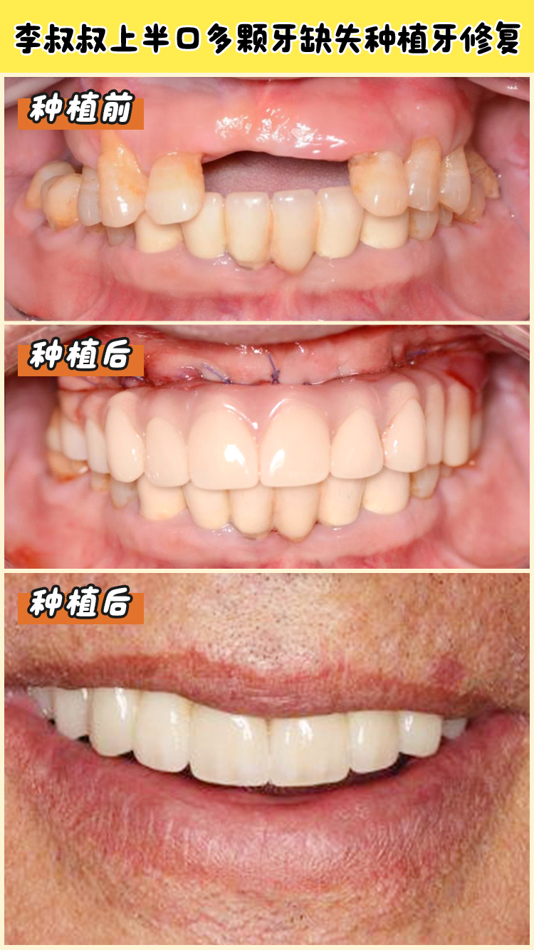 耒陽(yáng)雅貝康口腔的其他項(xiàng)目?jī)r(jià)格