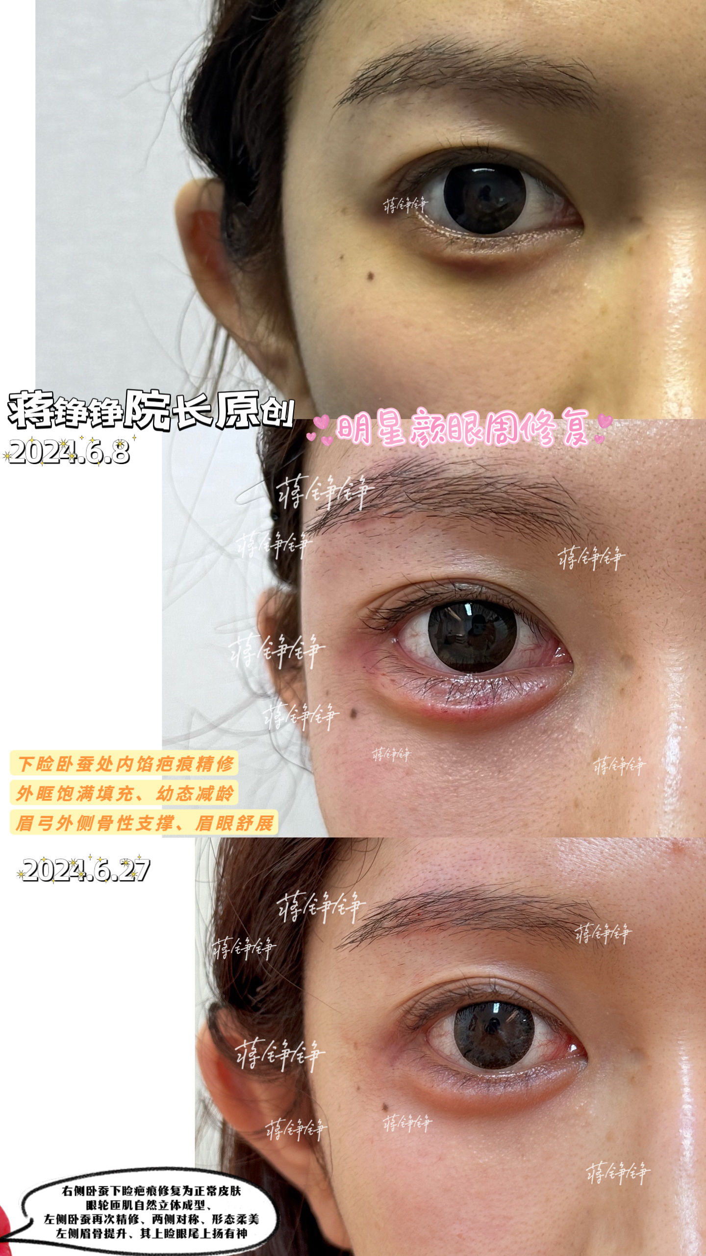 高性價比的祛疤之選