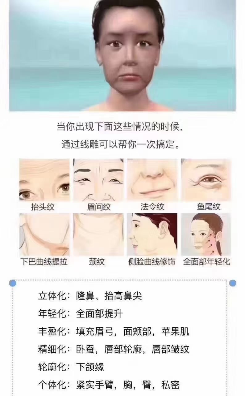 劉宇銅醫(yī)生眼鼻整形技術(shù)優(yōu)勢