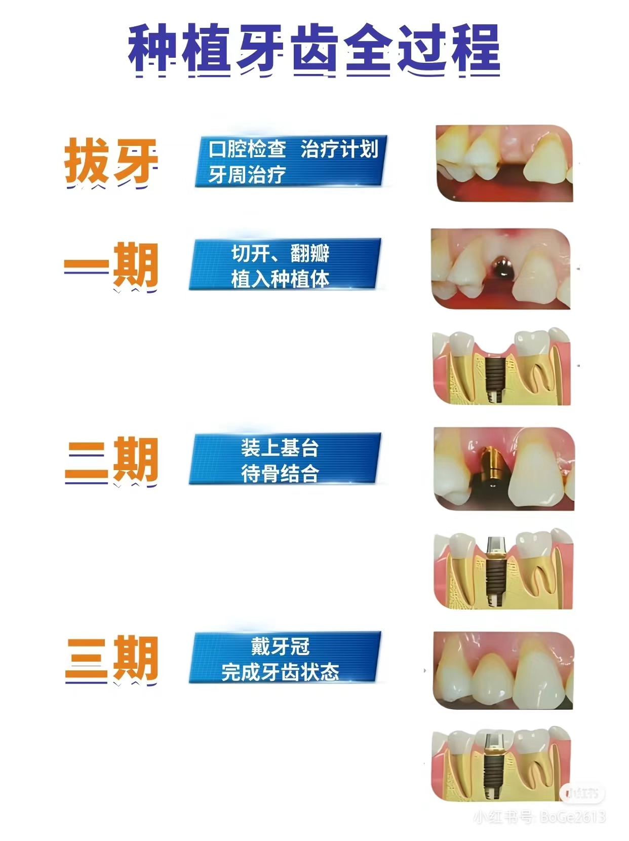 耒陽種植牙哪家好更靠譜？雅貝康口腔和綠島口腔，服務(wù)貼心沒話說！