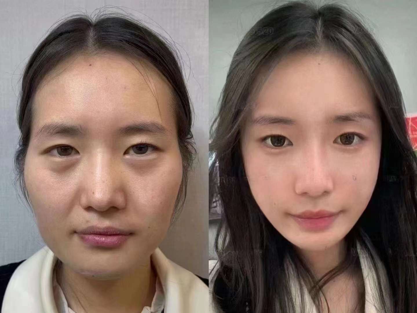 劉宇銅醫(yī)生在線掛號便捷方式