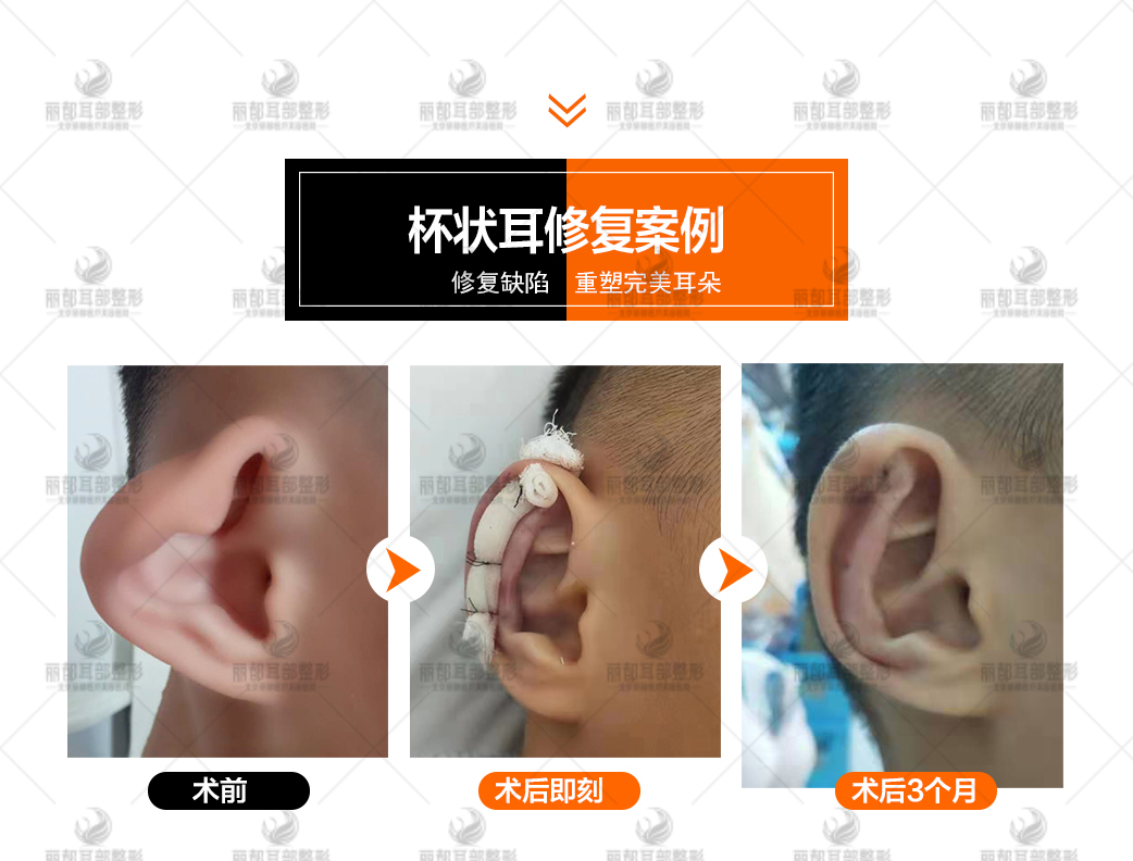 综合考量：如何选择适合自己的拉皮医生