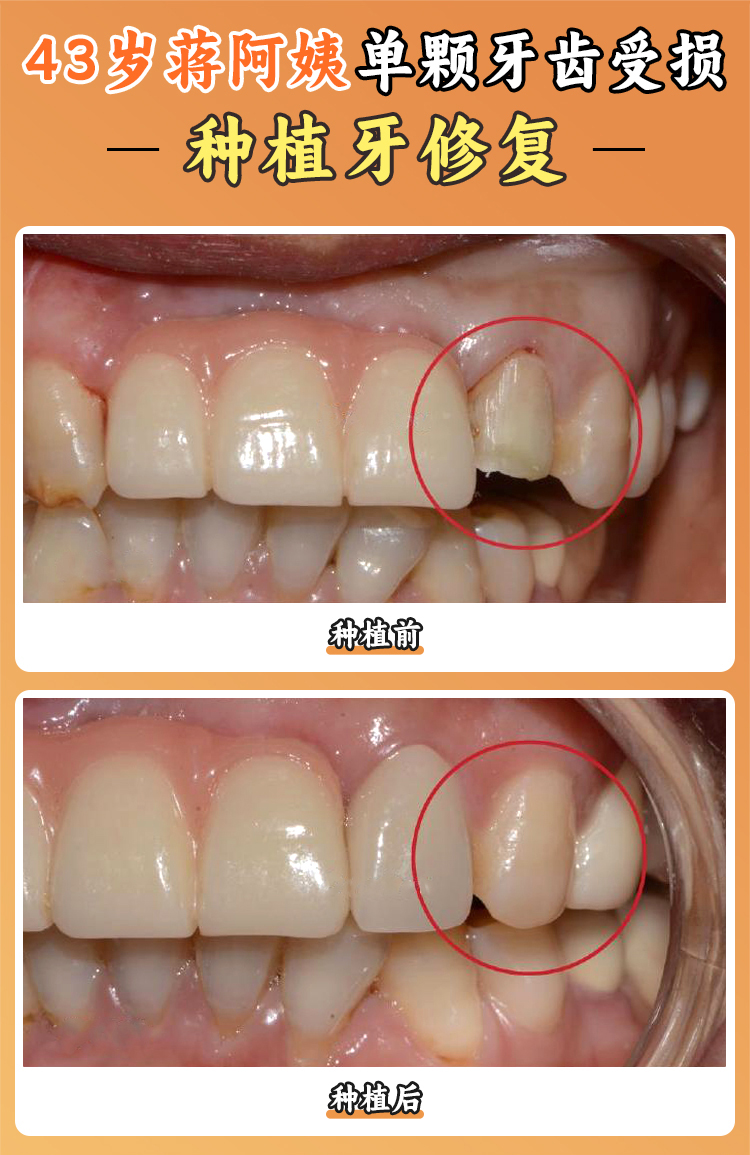 五、天津諾爾口腔的人性化服務(wù)