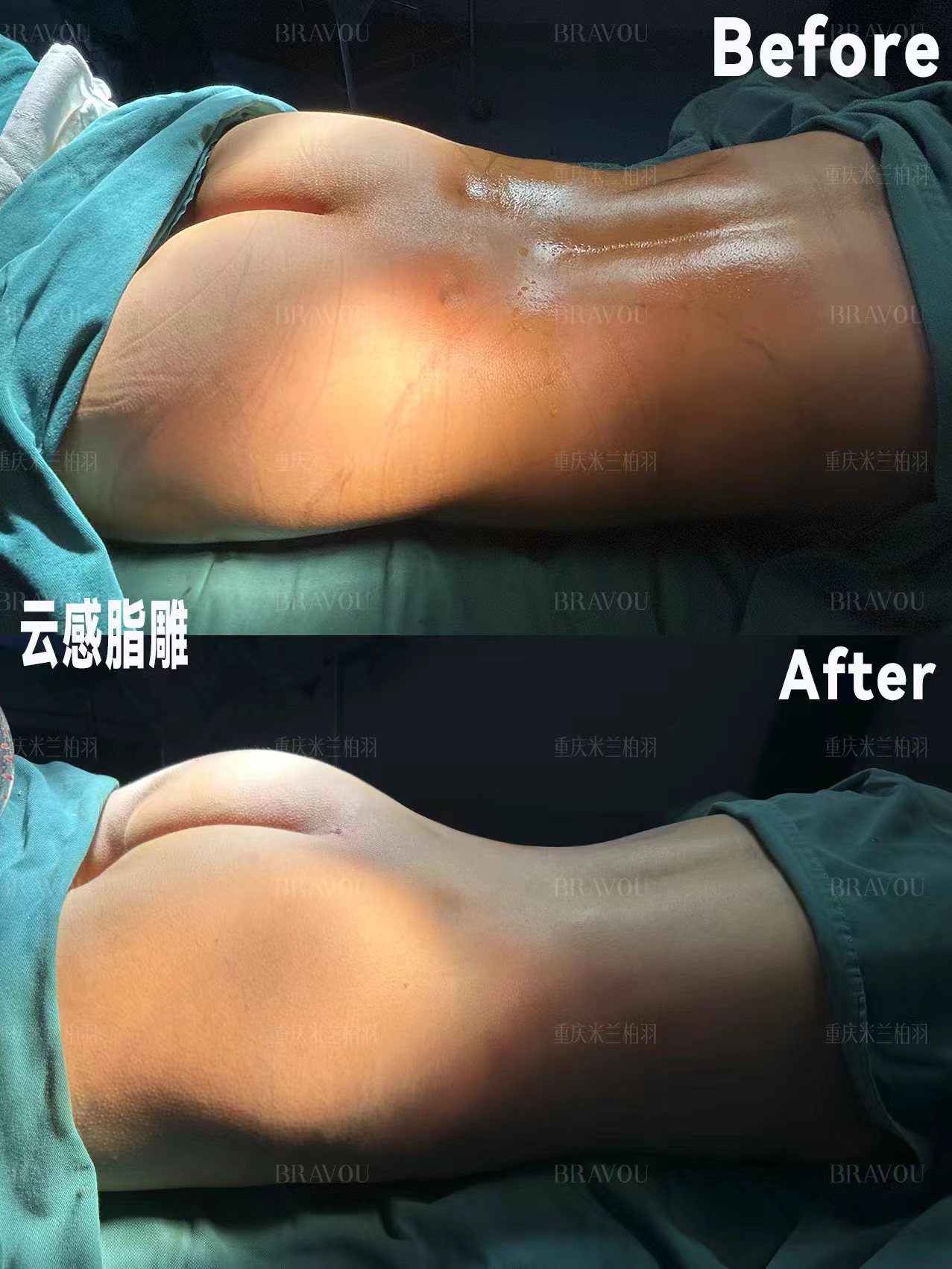 中信惠州醫(yī)院整形科:實(shí)力與口碑并存