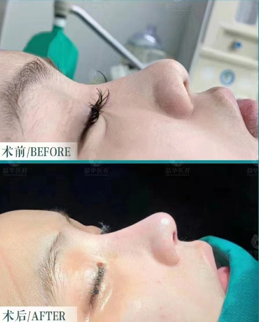 鄭州整形美容醫(yī)院張正文耳畸形整復(fù)口碑咋樣？