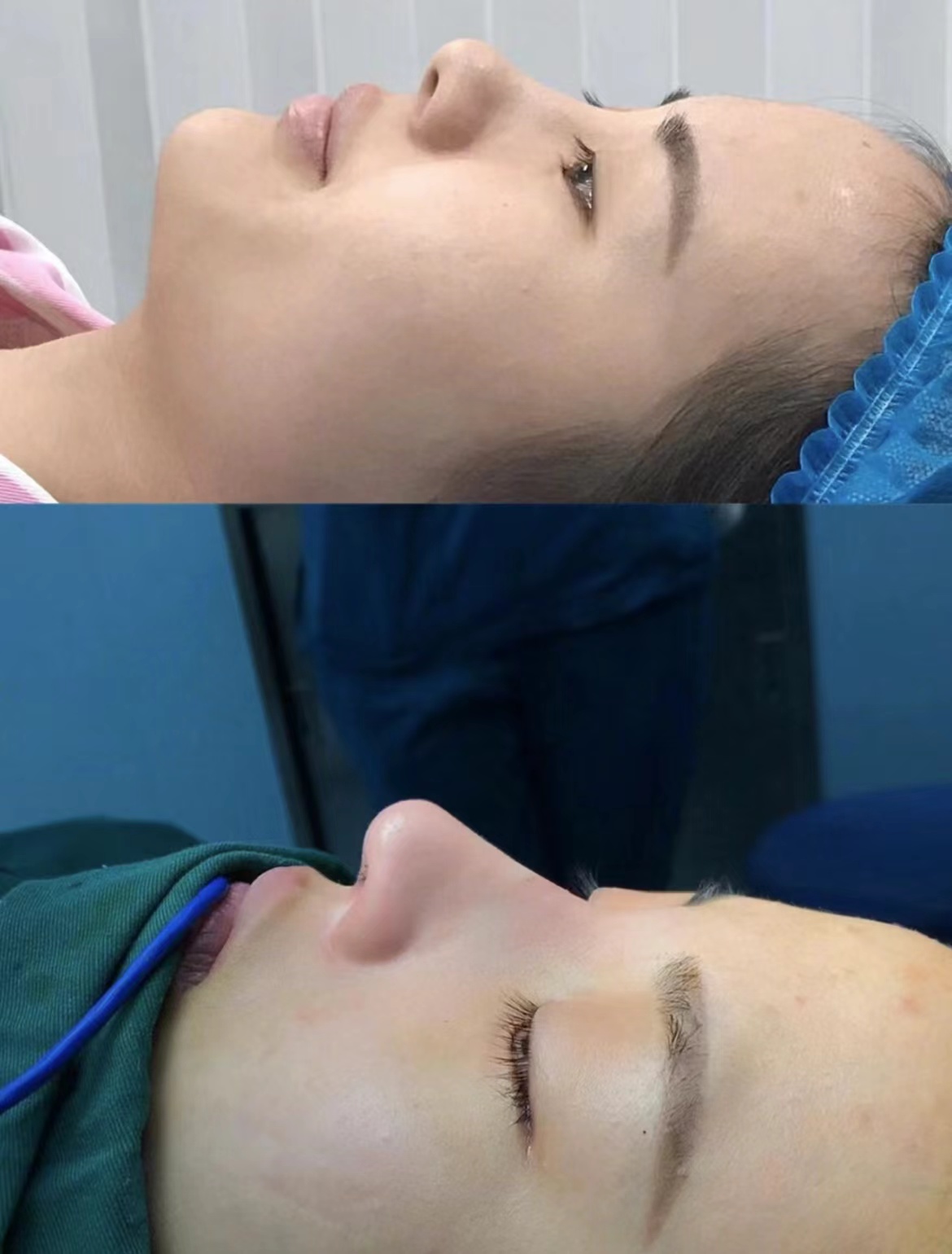 鄭州整形美容醫(yī)院張正文耳畸形整復(fù)有成功實(shí)例嗎？