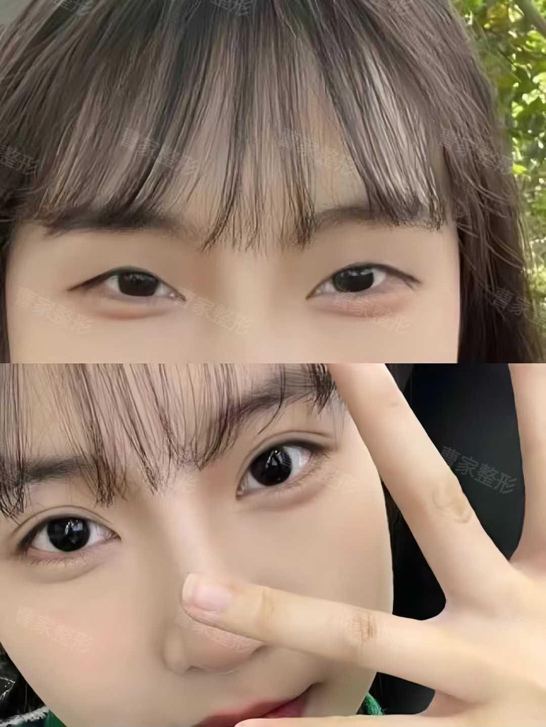 汕頭附二院整形美容科掛號攻略