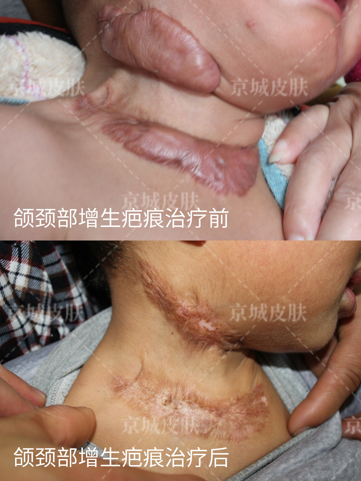 武漢中翰整形外科醫(yī)院拉皮手術(shù)情況