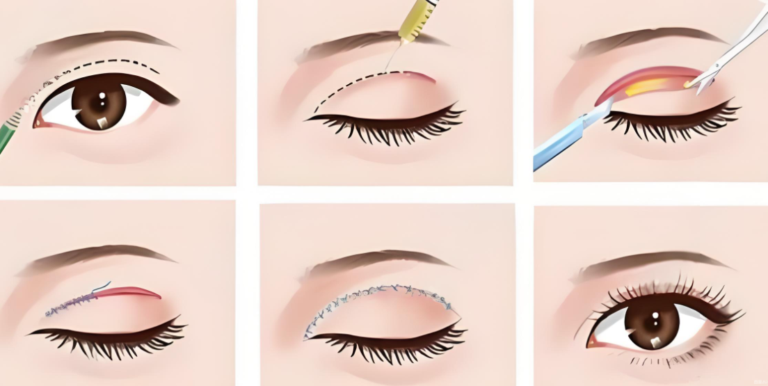 整形行业发展趋势与前景