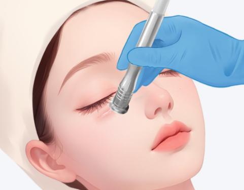 上海冰妍馬娟眼修復(fù)掛號通道開啟！專家號在線奉送，德國顯微鏡精準(zhǔn)修復(fù)