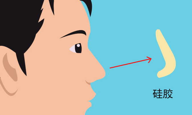 选择徐乃杰医生做鼻子修复的建议