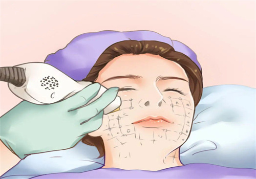 快來看 2026 杭州浙一醫(yī)院光子嫩膚價格表，合理定價讓你輕松擁有好肌膚！