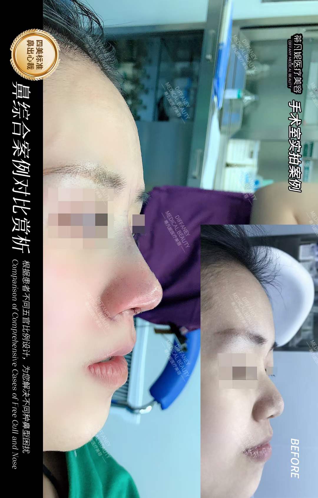 二、蔡躍波做臉部饅化修復(fù)的核心技術(shù)：從預(yù)防到修復(fù)的個性化方案