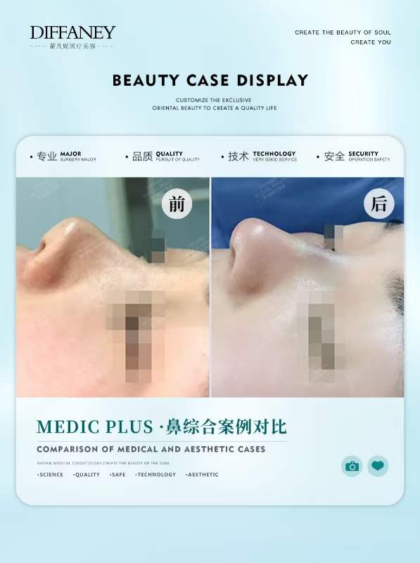 四、蔡躍波做臉部饅化的治療流程：從面診到術(shù)后的嚴謹把控